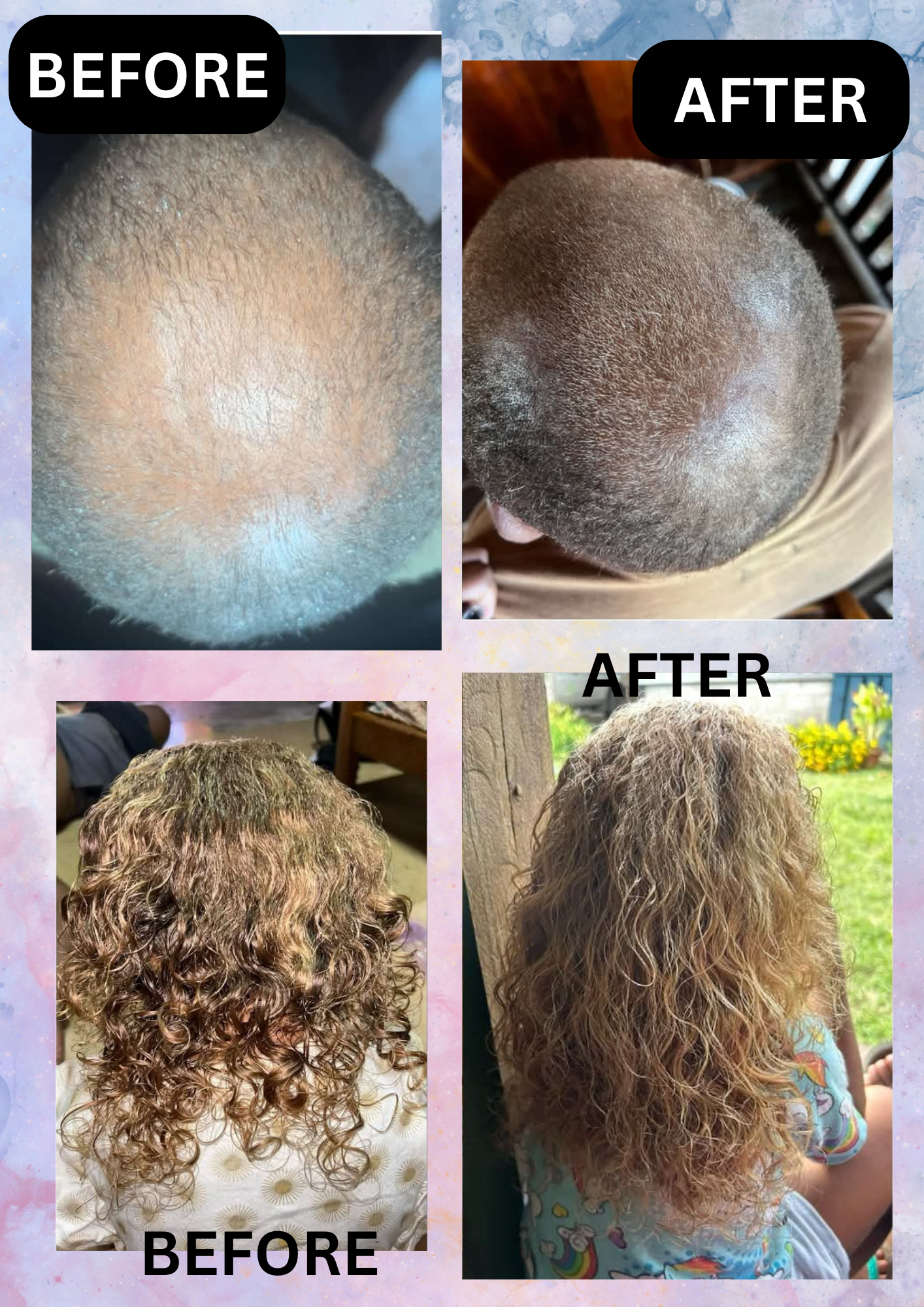 Sal's Rosemary Oil for Hair Growth