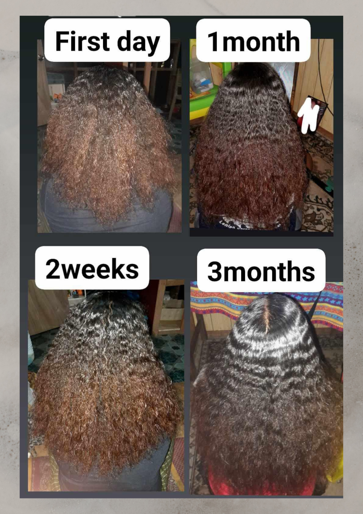 Sal's Rosemary Oil for Hair Growth